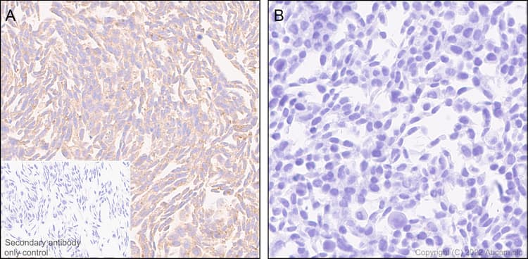 Rab8a Antibody Mjf R22 79 3 Mouse Igg2a Chimeric Bsa And Azide Free Ab307608  Immunohistochemistry Img406196