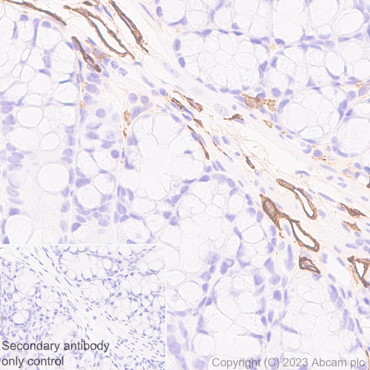 Anti-LYVE1 antibody [RM1067](AB314241)