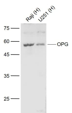 Anti-Osteoprotegerin antibody(AB203061)