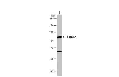 Loxl2 Antibody Ab96233  Western Blot Img445730