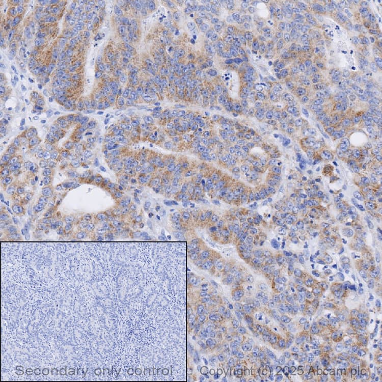 Anti-Frataxin antibody [18A5DB1](AB110328)