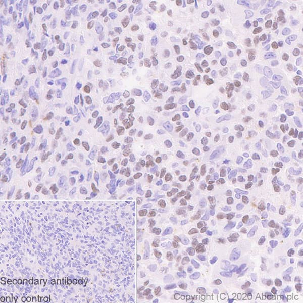 Human Histone H3.3 (Mutated G34W, G34V, G34R) Antibody Panel(AB274410)