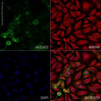 Anti-HLA Class I antibody [W6/32] - BSA and Azide free(AB23755)