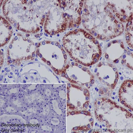 Stat6 Antibody Ye361 Ab32520 Immunohistochemistry Formalin Pfa Fixed Paraffin Embedded Sections Img112052