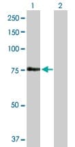 Fem1a Antibody Ab103421  Western Blot Img136507
