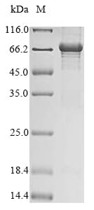 Ab289748  Sds Page Img180075