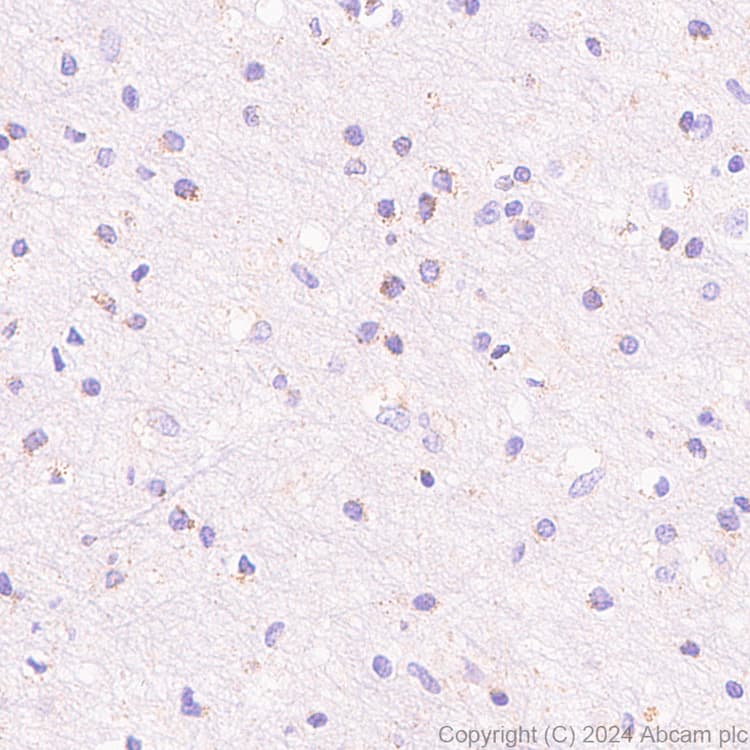 Anti-Slc25a1 antibody [EPR29193-92](AB318201)