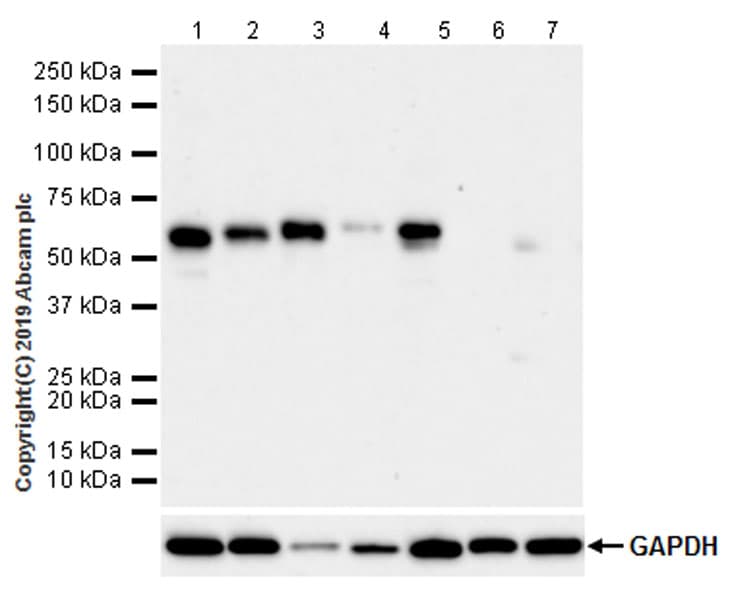 Anti-RUNX2 antibody [EPR22858-106] - ChIP Grade(AB236639)