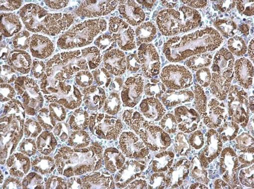 Etfa Antibody Ab153722  Immunohistochemistry Formalin Pfa Fixed Paraffin Embedded Sections Img124218