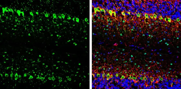 Anti-Parvalbumin antibody(AB256811)