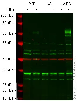 Anti-VCAM1 antibody [EPR5047](AB134047)
