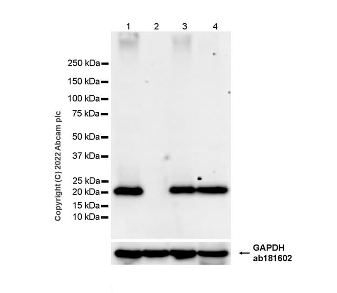 Rab8a Antibody Mjf R22 79 3 Mouse Igg2a Chimeric Bsa And Azide Free Ab307608  Western Blot Img406200