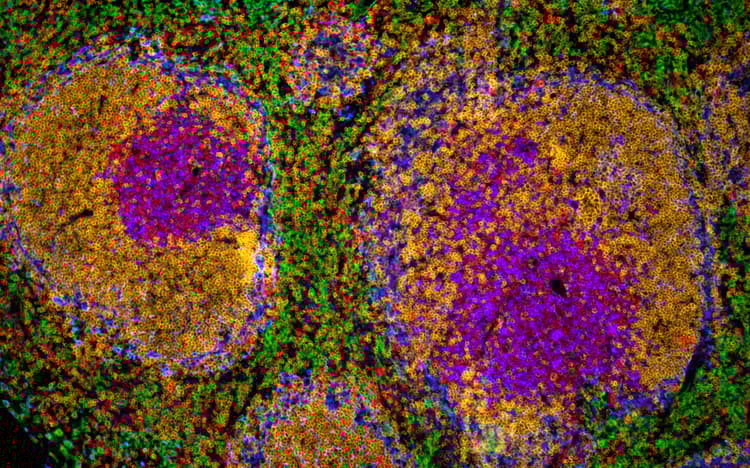 Multiplex IHC Detection kit (TSA amplification)(AB312827)