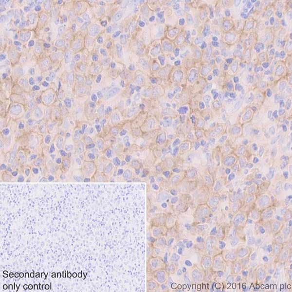 Cd40 Antibody Epr20540 Bsa And Azide Free Ab271995  Immunohistochemistry Formalin Pfa Fixed Paraffin Embedded Sections Img52471