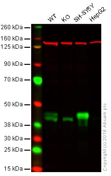 Anti-Islet 1 antibody [EPR10362](AB178400)