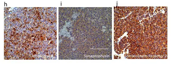 Anti-Somatostatin Receptor 2 antibody [UMB1] - C-terminal(AB134152)