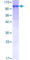 Recombinant Human Ezrin protein(AB132943)