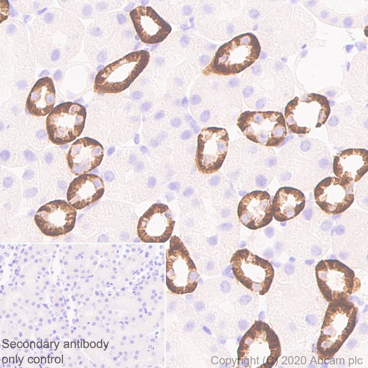 Casr Antibody Epr24050 59 Bsa And Azide Free Ab280360  Immunohistochemistry Formalin Pfa Fixed Paraffin Embedded Sections Img108958