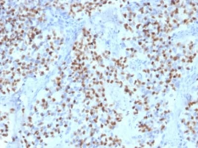 Anti-Oct-2 antibody [OCT2/2136](AB236534)
