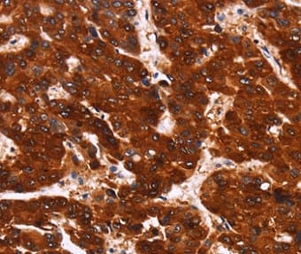 Gpcr Gpr124 Antibody Ab198817  Immunohistochemistry Formalin Pfa Fixed Paraffin Embedded Sections Img45055