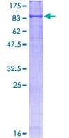 Recombinant Human Keap1 protein (Tagged)(AB132384)