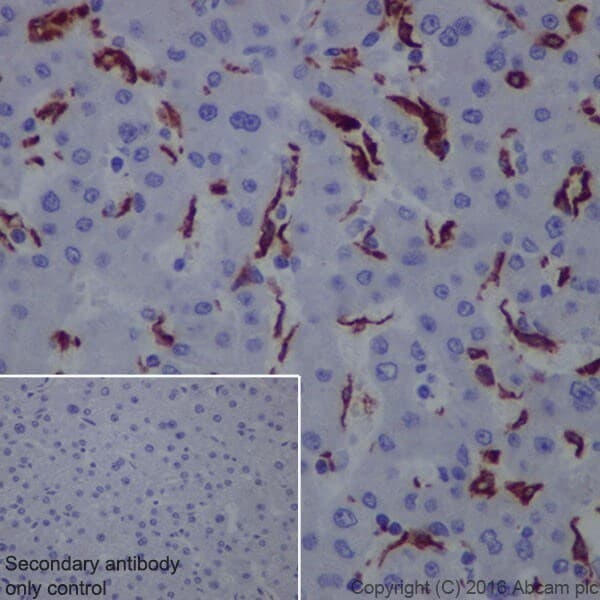 Macrophage Polarization Panel - Human IHC(ab278180)