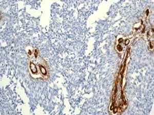 Anti-CD146 antibody [EPR3208](ab75769)