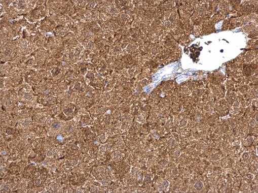 Liver Fabp Antibody Ab227066  Immunohistochemistry Formalin Pfa Fixed Paraffin Embedded Sections Img26936