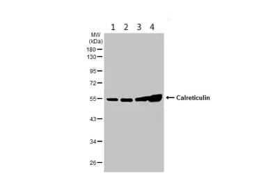 Anti-Calreticulin antibody(AB227444)