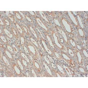 Anti-IGF1 antibody [7973](AB176523)