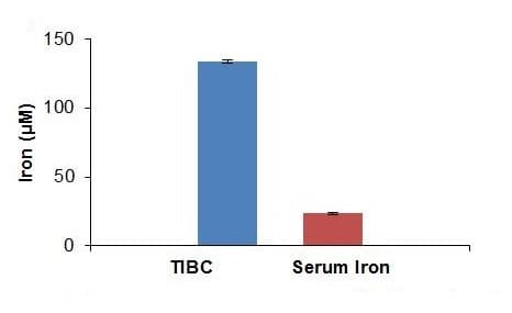 Total Iron-Binding Capacity (TIBC) and Serum Iron Assay Kit(AB239715)