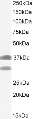 Siah1 Antibody Ab2237  Western Blot Img403704