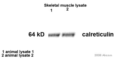 Anti-Calreticulin antibody - ER Marker(AB2907)
