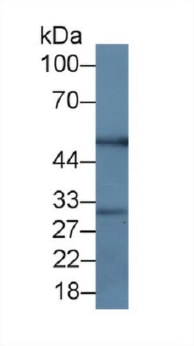 Anti-RANKL antibody [C1](AB239607)