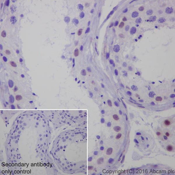 Anti-Steroidogenic Factor 1/SF-1 antibody [EPR19744](AB217317)
