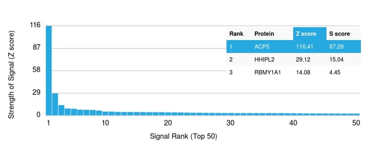 Anti-Tartrate Resistant Acid Phosphatase antibody [rACP5/1070](AB238033)