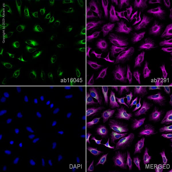 Anti-Cyclophilin B antibody(AB16045)