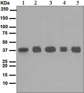 Anti-Rad51 antibody [EPR4030(3)](AB133534)