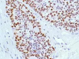 Anti-Estrogen Receptor alpha antibody [SP1](AB16660)