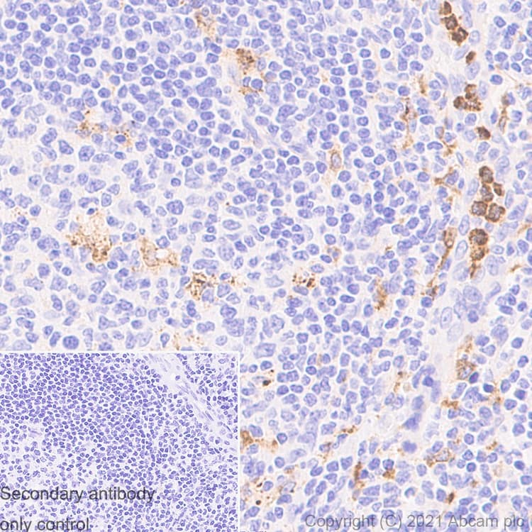 Anti-MMP9 antibody [RM1020](AB283575)