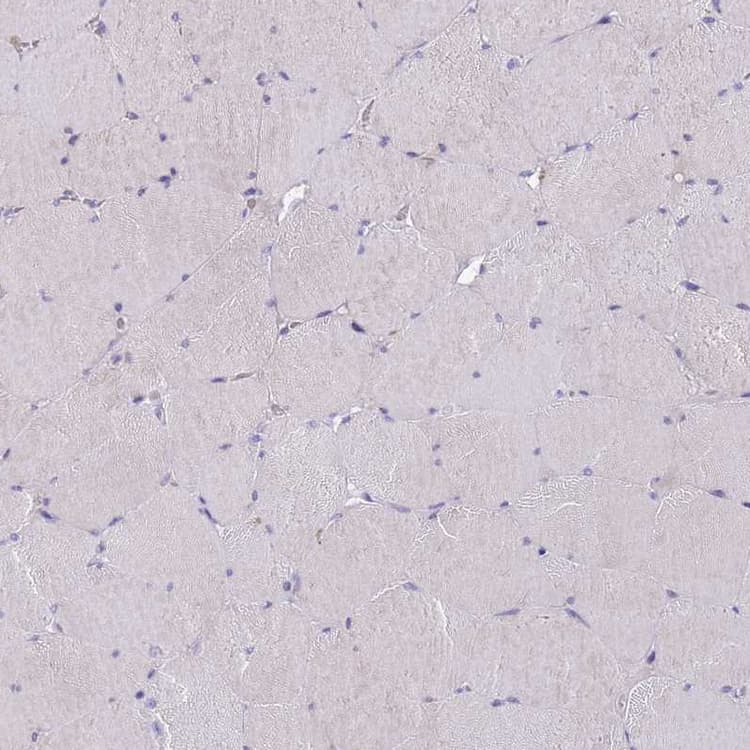 Ddhd1 Antibody Ab151078  Immunohistochemistry Formalin Pfa Fixed Paraffin Embedded Sections Img41248