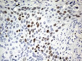 Anti-Ki67 antibody [OTI5D7](AB156956)