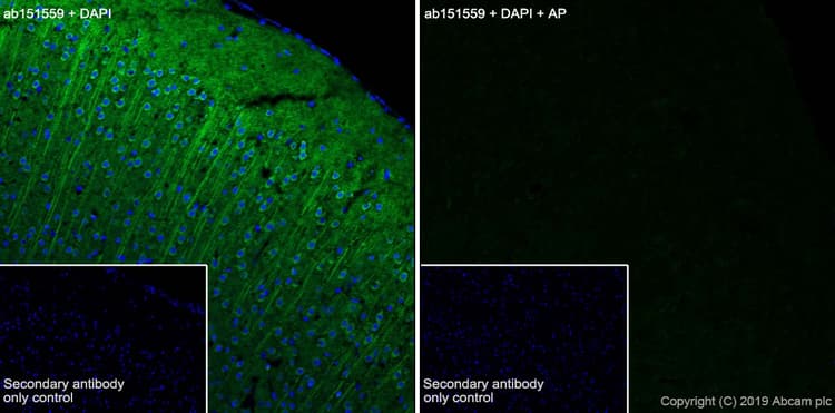 Anti-Tau (phospho T231) antibody [EPR2488] - BSA and Azide free(AB156624)
