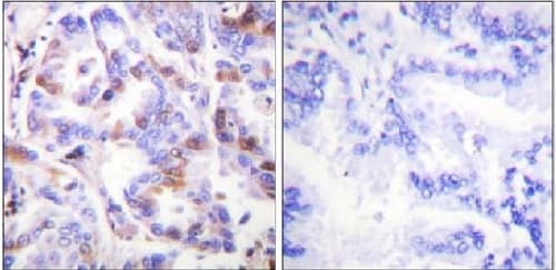 Anti-RPA32/RPA2 (phospho T21) antibody(AB61065)