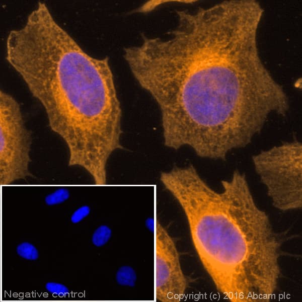 Donkey Anti-Rabbit IgG H&L (Alexa Fluor® 594)(AB150076)