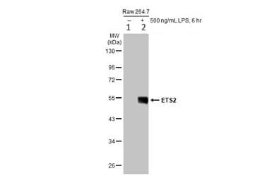 Ets2 Antibody Ab272866  Western Blot Img450540