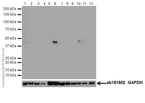 Anti-Alpha Skeletal Muscle Actin antibody [EPR18430] - BSA and Azide free(AB250775)