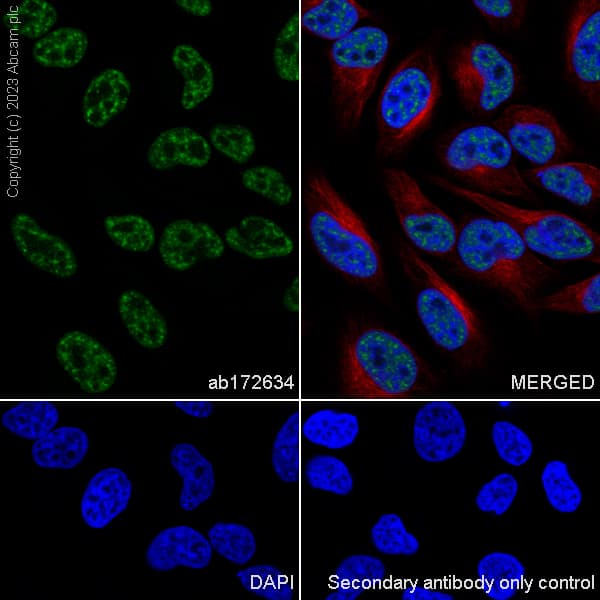 Anti-SF3B1 antibody [EPR11986](AB172634)