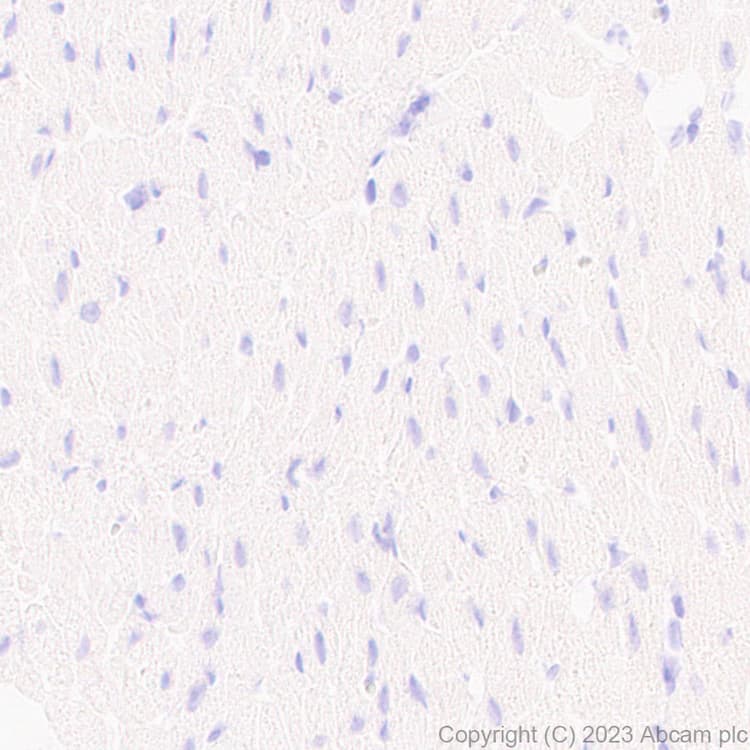 Anti-Kir4.1/KCNJ10 antibody [EPR27251-74](AB312844)