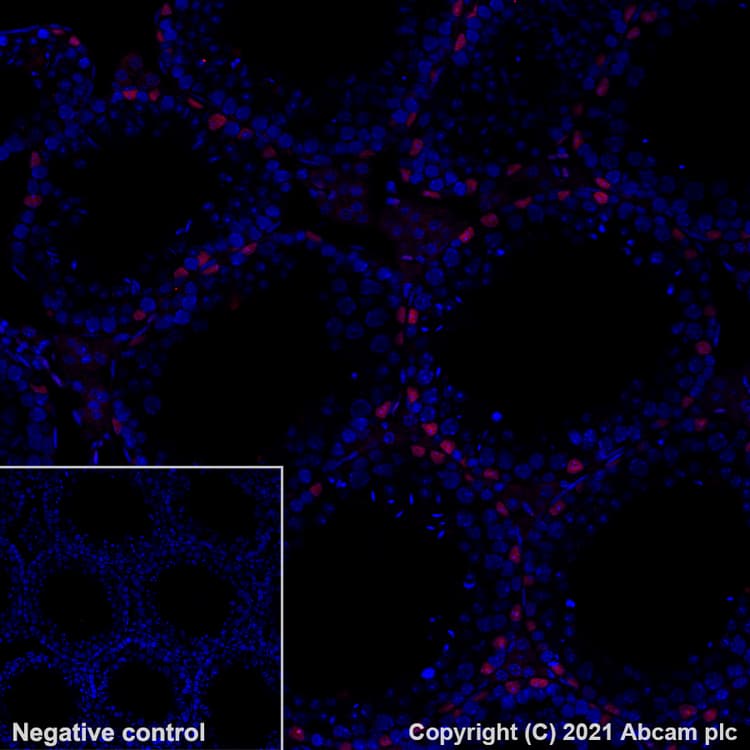 Alexa Fluor® 647 Anti-Wilms Tumor Protein antibody [EPR23963-116](AB283325)
